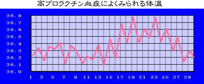 高プロラクチン血症によくみられる体温